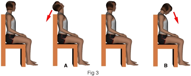 Imagen ilustrativa: 4 dibujos, muñeca sentada en una silla: 1 reposo, 2 extensión del cuello, 3 reposo, 4 flexión del cuello